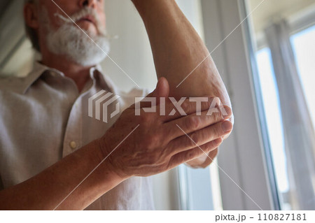 Senior man lubricating with analgetic cream his elbow. 110827181