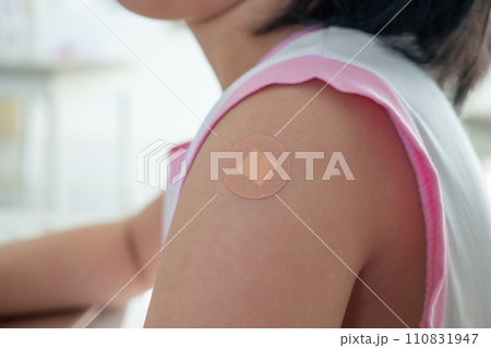 Vaccinated little asian girl with adhesive plaster after vaccine injection 110831947
