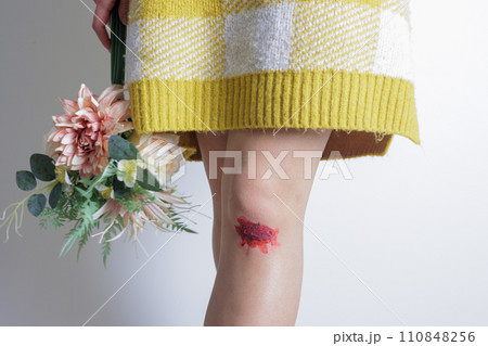 花束と怪我をした女性の脚 110848256