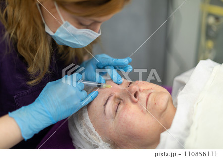 The cosmetologist carefully performs tiny injections on the skin of his client's forehead. The cosmetologist carefully performs tiny injections on the skin of his client's forehead. 110856111