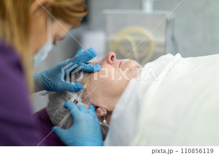A nurse inserts a needle into the facial skin of a clinic patient. A nurse inserts a needle into the facial skin of a clinic patient. 110856119