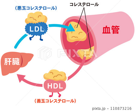 LDLとHDLの仕組み　脂質異常症　血管　コレステロール 110873216