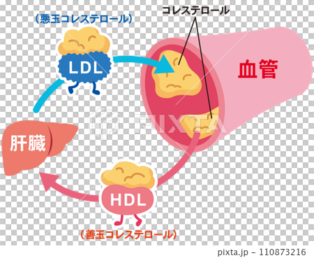 LDLとHDLの仕組み　脂質異常症　血管　コレステロール 110873216