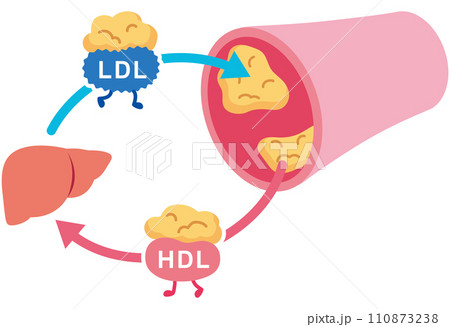 LDLとHDLの仕組み　脂質異常症　血管　コレステロール 110873238