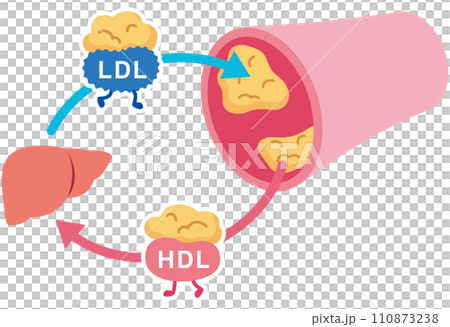 LDLとHDLの仕組み　脂質異常症　血管　コレステロール 110873238
