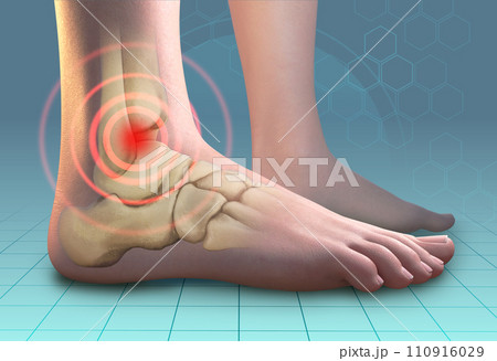 Ankle pain symptoms 110916029