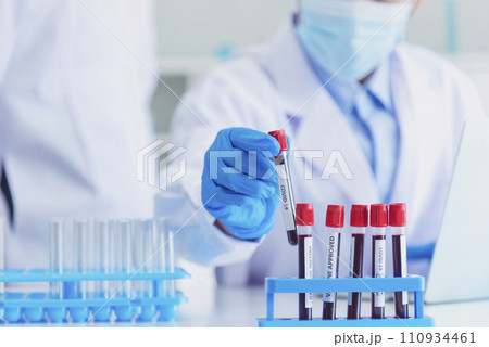 Close up Scientist man hands holding sample blood test tube science laboratory. Doctor clinic healthcare technician lab testing blood sample diagnosis. Crop man scientist hands testing medical lab Close up Scientist man hands holding sample blood test tube science laboratory. Doctor clinic healthcare technician lab testing blood sample diagnosis. Crop man scientist hands testing medical lab 110934461