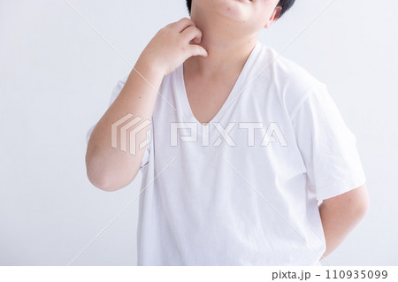 身体を痒がる子ども　itchy body 110935099