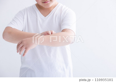 身体を痒がる子ども itchy body 身体を痒がる子ども itchy body 110935101