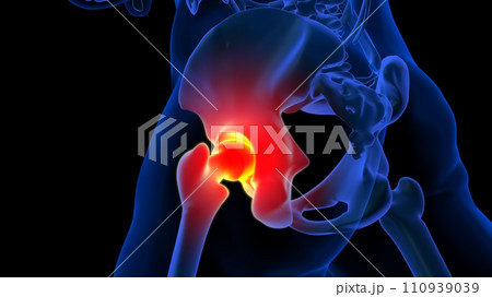 Hip joint pain anatomy for medical concept 3D rendering Hip joint pain anatomy for medical concept 3D rendering 110939039