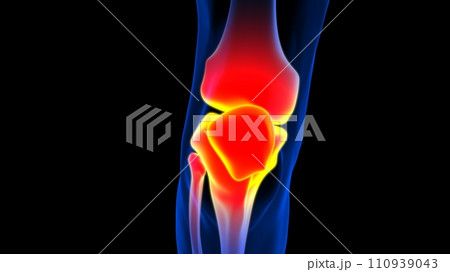 Knee joint pain anatomy for medical concept 3D rendering 110939043