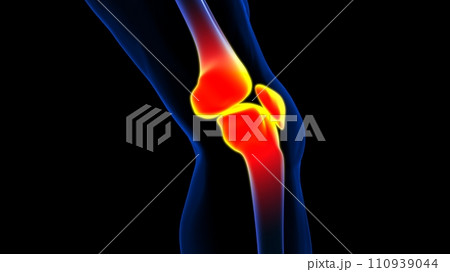 Knee joint pain anatomy for medical concept 3D rendering Knee joint pain anatomy for medical concept 3D rendering 110939044