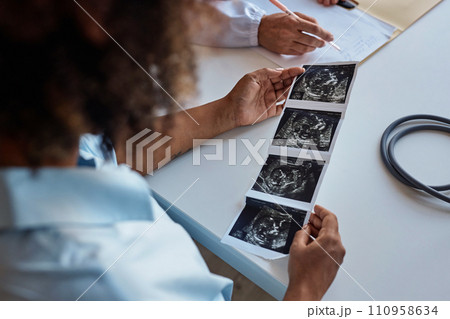 Over the shoulder of unborn baby ultrasonography picture in hands of African American woman at consultation in clinic Over the shoulder of unborn baby ultrasonography picture in hands of African American woman at consultation in clinic 110958634