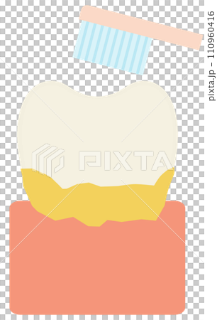 teeth and plaque teeth and plaque 110960416