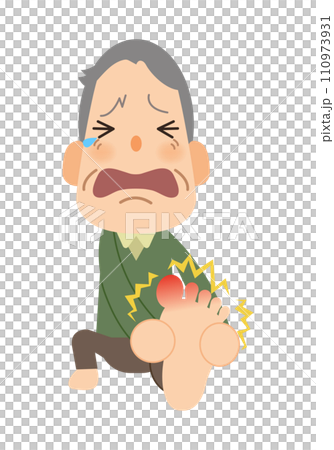 Grandpa_ Chilblains on legs 110973931