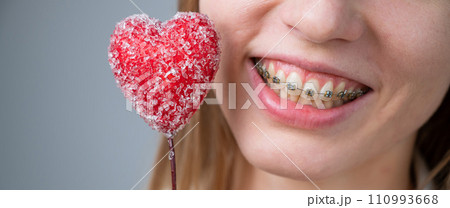 Cute woman with braces on her teeth holds a candy in the form of a heart on white background. Widescreen.  110993668