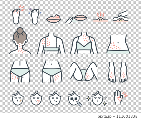 女性皮膚炎的部位 女性皮膚炎的部位 111001838