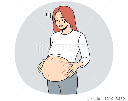 Pregnant woman with stretchmarks on belly 111043820