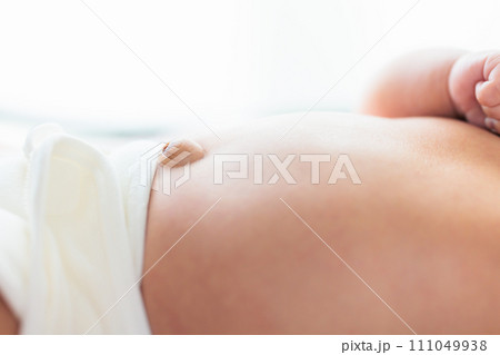 赤ちゃんのおへそ　生後1ヶ月　でべそ　臍ヘルニア 111049938