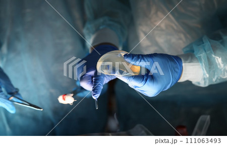 Surgeons hands holding breast implants and tools 111063493