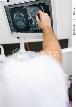 Vertical shot of male dentist pointing at teeth radiography on monitor to explain dentition diagnosis to young man patient with toothache. Dental expert showing x-ray scan results to man. 111063722