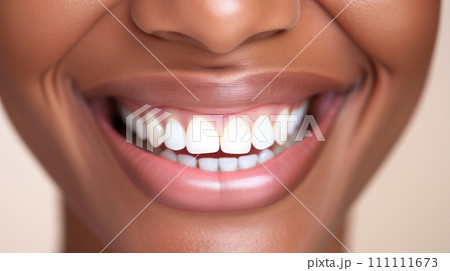 Beautiful smile closeup 111111673