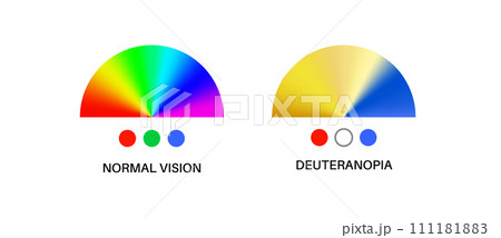 Deuteranomaly and deuteranopia Deuteranomaly and deuteranopia 111181883