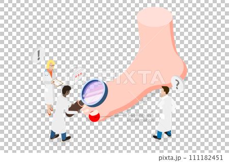 3D Isometric Flat  Conceptual Illustration of Ingrown Toenail 111182451