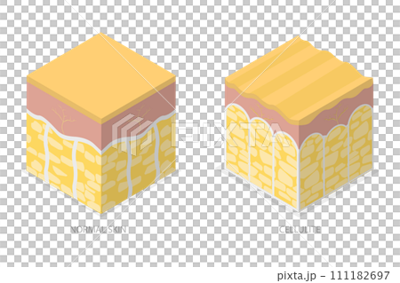 3D Isometric Flat  Conceptual Illustration of Cellulite Skin, Womans Beauty and Skicare 111182697