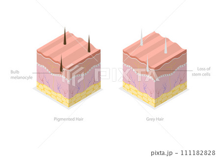 3D Isometric Flat  Conceptual Illustration of Pigmanted And Gray Hair, Melanocyte Stem Cells 111182828