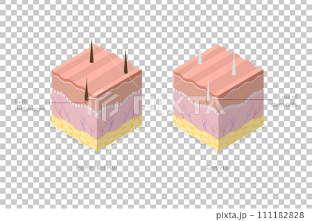 3D Isometric Flat  Conceptual Illustration of Pigmanted And Gray Hair, Melanocyte Stem Cells 111182828