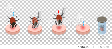 3D Isometric Flat Conceptual Illustration of How To Remove a Tick 3D Isometric Flat Conceptual Illustration of How To Remove a Tick 111189226