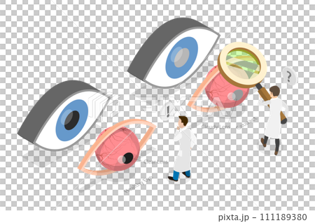 3D Isometric Flat  Conceptual Illustration of Cataract 111189380