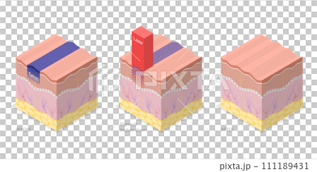 3D Isometric Flat Conceptual Illustration of Laser Tattoo Removing 3D Isometric Flat Conceptual Illustration of Laser Tattoo Removing 111189431