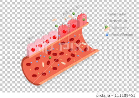 3D Isometric Flat  Conceptual Illustration of Leaky Gut Syndrome 111189453