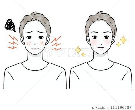 正面を向いた肌荒れに悩む男性のビフォーアフターのイラストセット 111196587