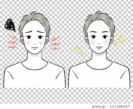 正面を向いた肌荒れに悩む男性のビフォーアフターのイラストセット 111196587