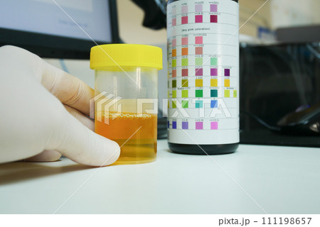 Urine analysis in laboratory. 111198657