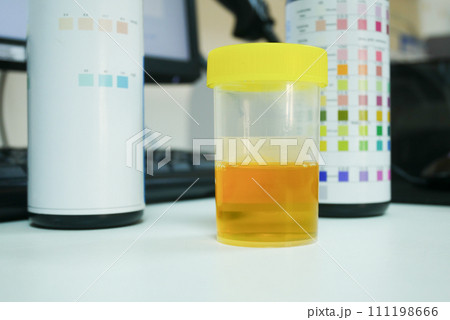 Urine analysis in laboratory. Urine analysis in laboratory. 111198666