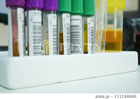 Urine analysis in laboratory. 111198668