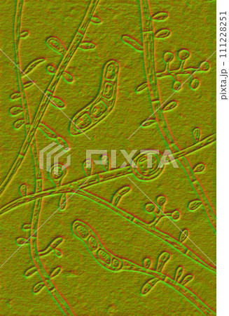 Fungus Trichophyton tonsurans, 3D illustration Fungus Trichophyton tonsurans, 3D illustration 111228251