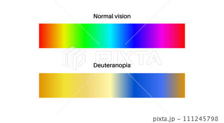 Deuteranomaly and deuteranopia 111245798