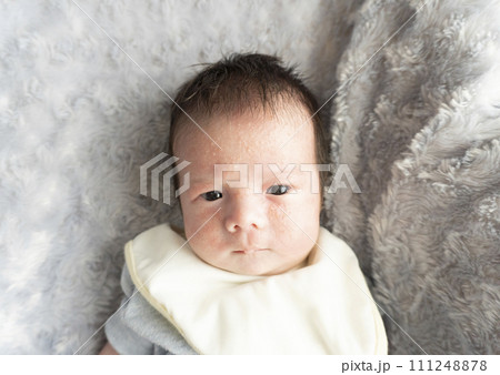 新生児の乳児湿疹 新生児の乳児湿疹 111248878