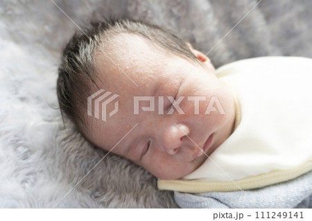 新生児の乳児湿疹 111249141