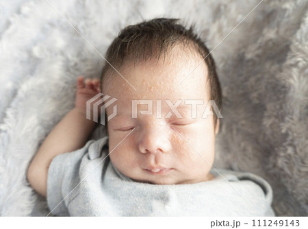 新生児の乳児湿疹 新生児の乳児湿疹 111249143