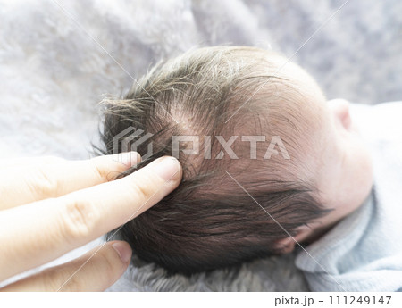 脂漏性湿疹ができている新生児の頭 111249147