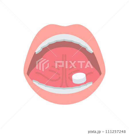 花粉症の舌下免疫療法イメージ（スギ花粉エキスの錠剤を置く） 111257248