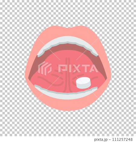 花粉症の舌下免疫療法イメージ（スギ花粉エキスの錠剤を置く） 111257248