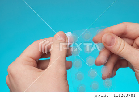Close-up round acne patch on finger on blue background. Acne patches for treatment of pimple and rosacea close-up. Facial rejuvenation cleansing cosmetology Close-up round acne patch on finger on blue background. Acne patches for treatment of pimple and rosacea close-up. Facial rejuvenation cleansing cosmetology 111263781