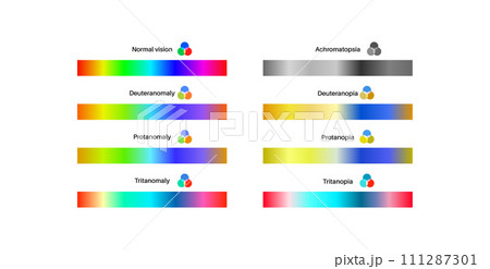 Color blindness poster 111287301